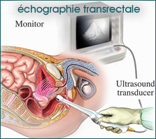 erectyle dysfuction