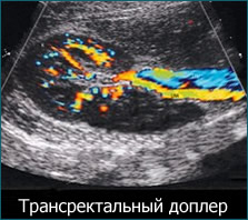 doppler ultrasound