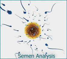 semen Analysis